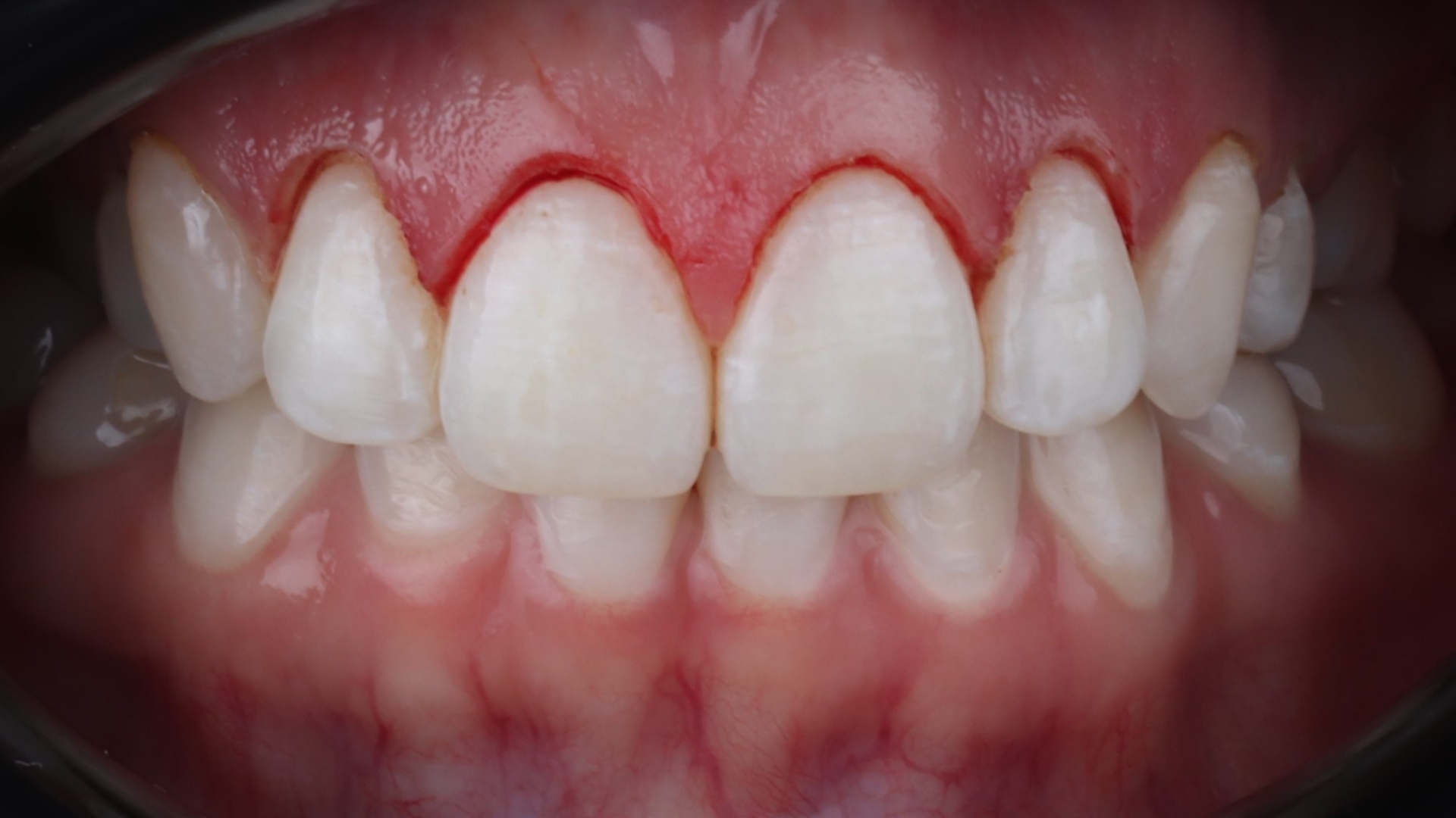Periodoncia